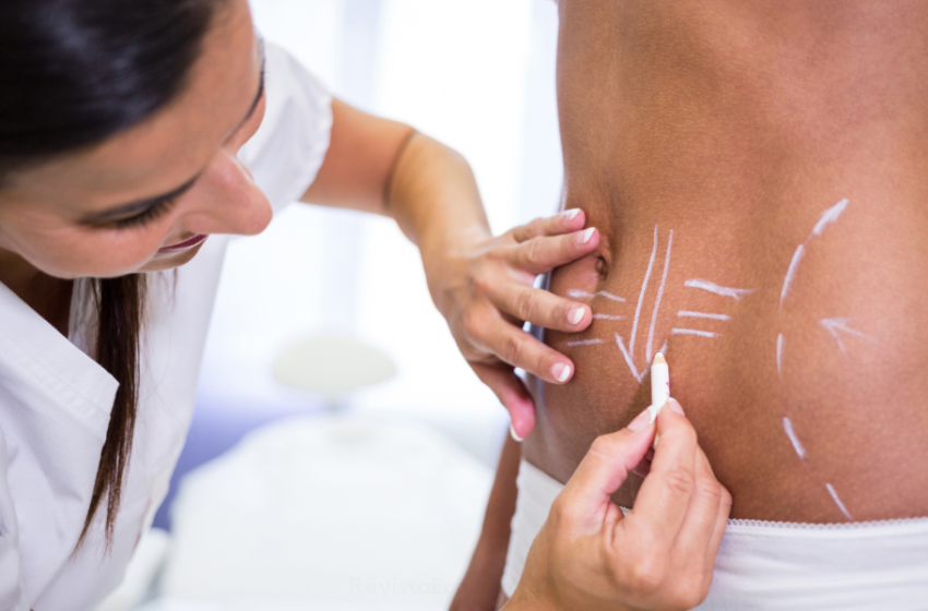 Prepárate para el verano: Elimina la grasa localizada y reafirma tu cuerpo con naturalidad y armonía.