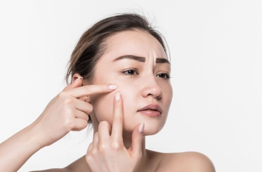 Primer Summit de Skincare & Health: el acné es el motivo más frecuente de consultas a dermatólogos a nivel mundial