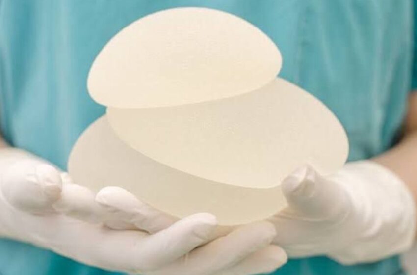 Los implantes en la cirugía plástica: ¿cuáles son las intervenciones más populares entre los peruanos?