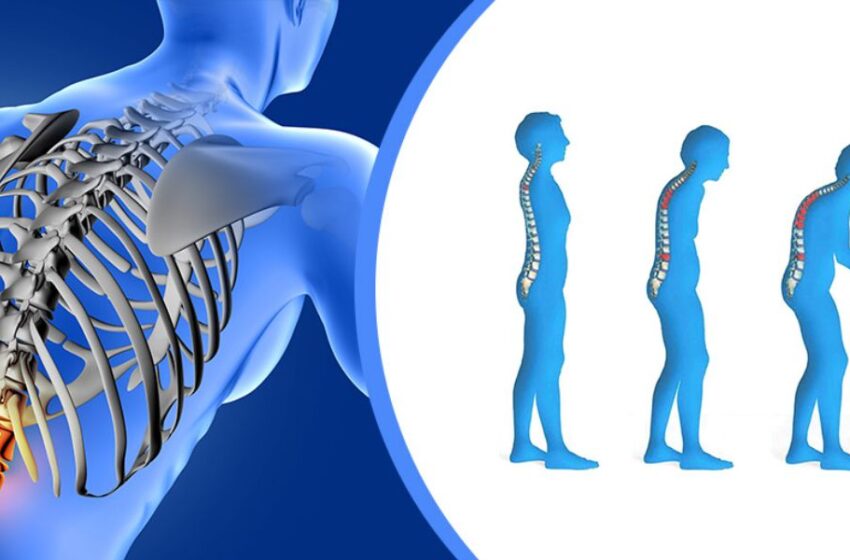 Prevenir la osteoporosis empieza joven: lo que hagas hoy cambiará tu vejez