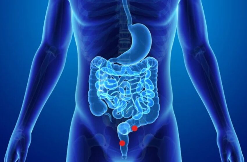 ¿Por qué algunos cánceres de colon hacen metástasis en el cerebro? La genética podría tener la clave